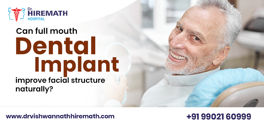 full-mouth-dental-implants-facial-structure